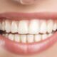 cosmetic dentistry